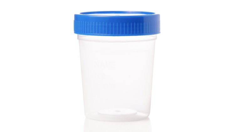 Specimen Container